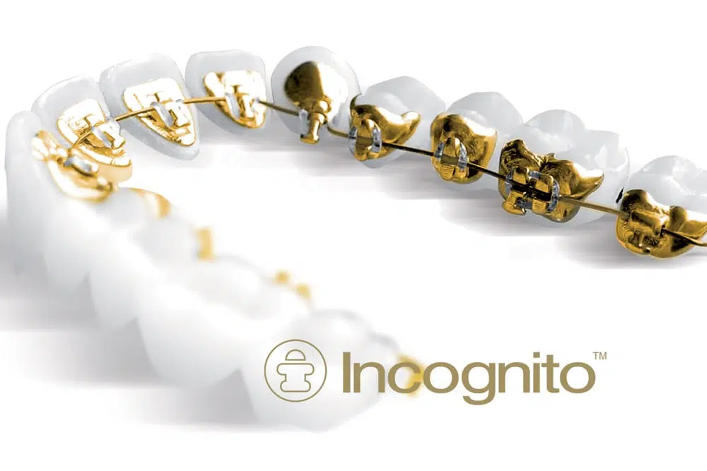 Incognito
